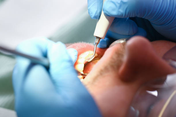 Best Dentist for Tooth Abscess  in Wautoma, WI